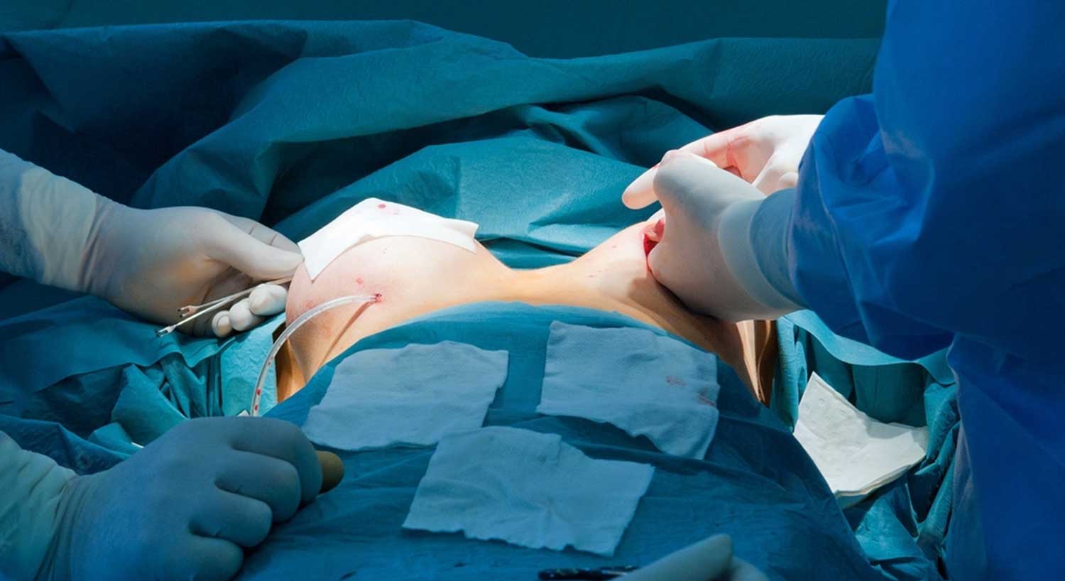 Breast surgery Treatment Hospital Bangalore